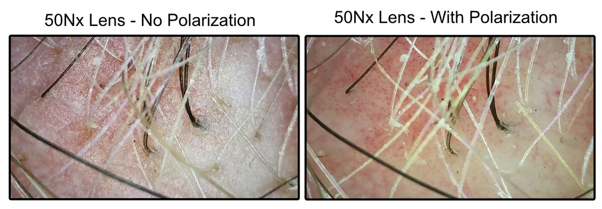 ProScope T1 Kit w/50Nx and 200x lens - WiFi Microscope – ProScope USA