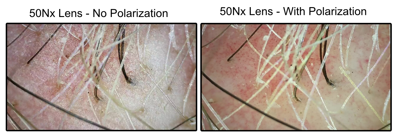 ProScope T1 w/50Nx Polarized Lens - WiFi Microscope