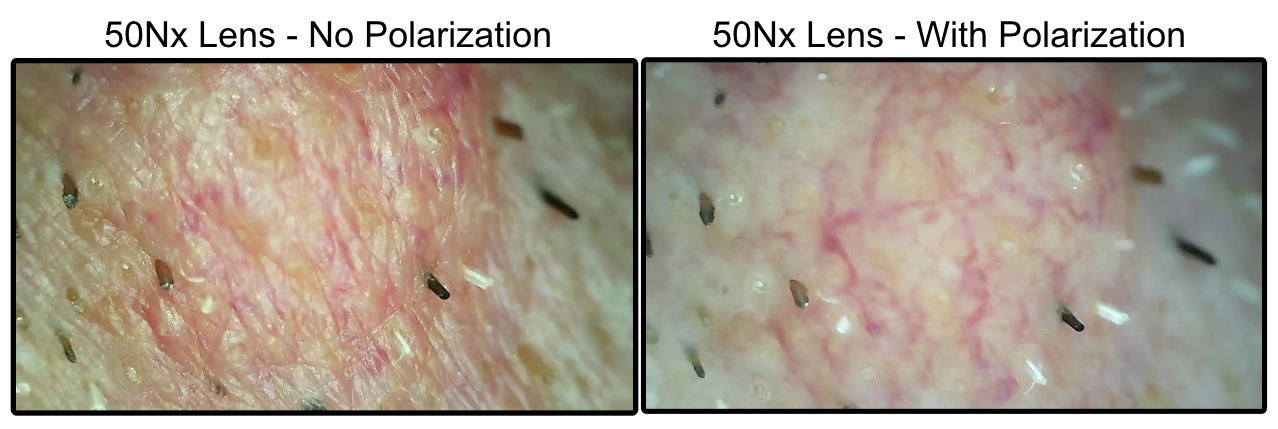 ProScope T1 w/50Nx Polarized Lens - WiFi Microscope