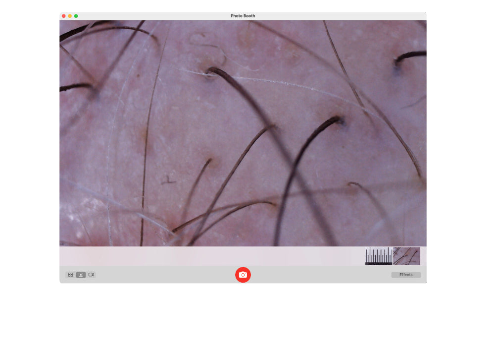 ProScope T2 Trichology Kit w/50x - USB Microscope