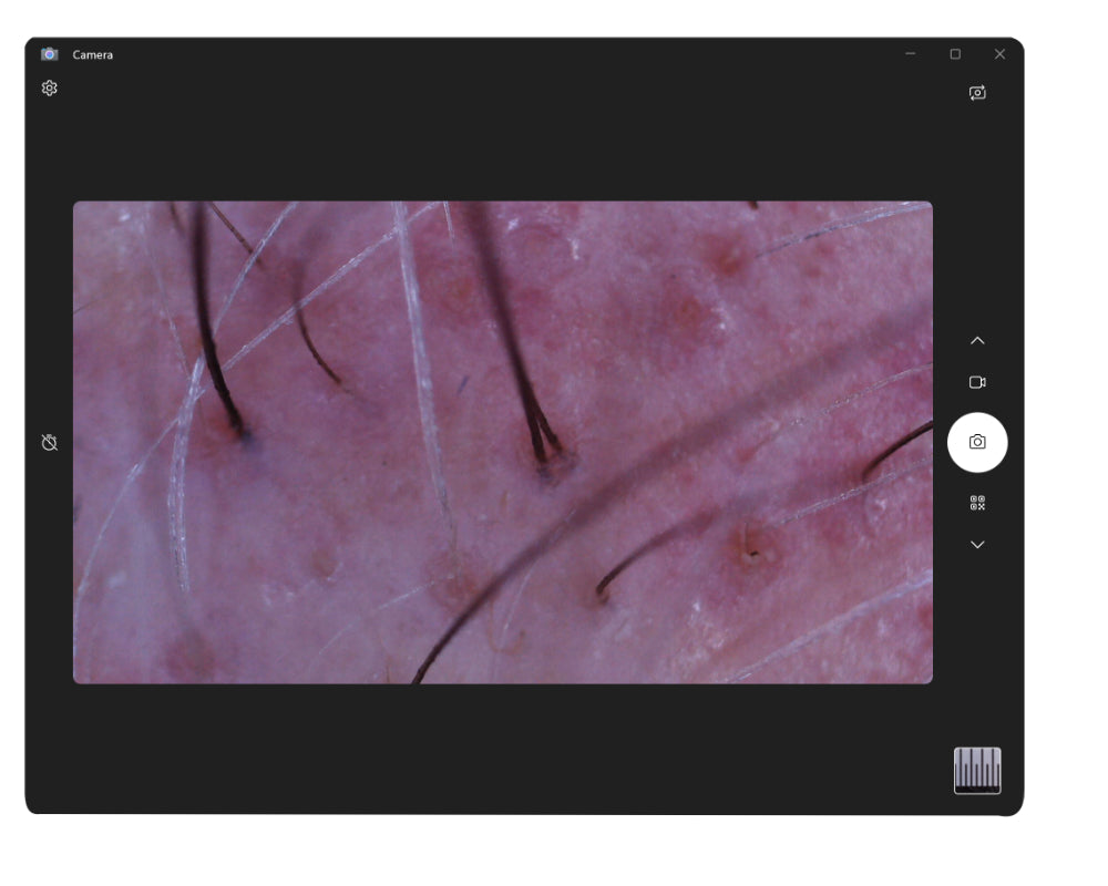 ProScope T2 Trichology Kit w/50x - USB Microscope
